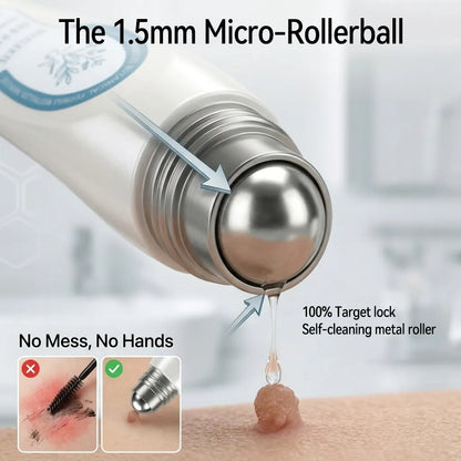 Official Brand Store |✅🧑🏻‍⚕️Natravor® 7-Day Tag & Spot Eraser(Zero Pain, Zero Scars Rollerball)